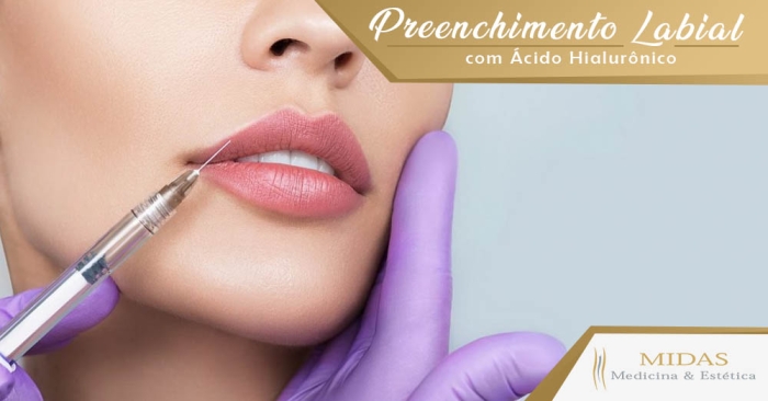 Preenchimento Labial - com Ácido Hialurônico