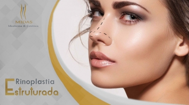 Rinoplastia Estruturada