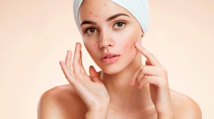 Adeus marcas de acne!