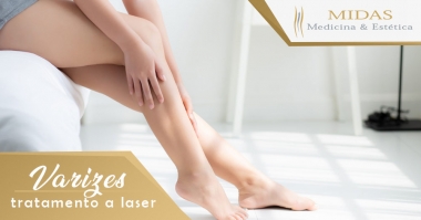 Varizes: Tratamento a Laser