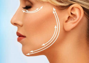 Bioplastia Facial, tire suas dúvidas