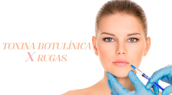 Rugas X Botox®