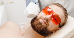 Depilação a Laser de Barba