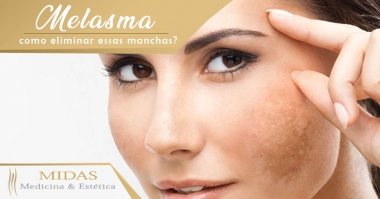 Melasma - Como eliminar essas manchas da pele?