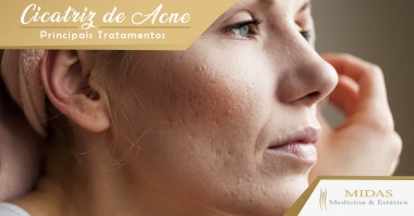 Cicatriz de Acne - Principais Tratamentos